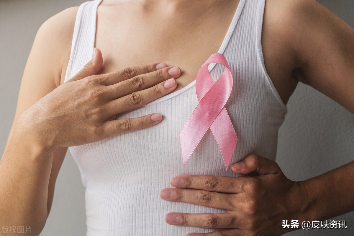 运动可以防止乳腺癌吗,乳腺癌通过运动能治愈吗