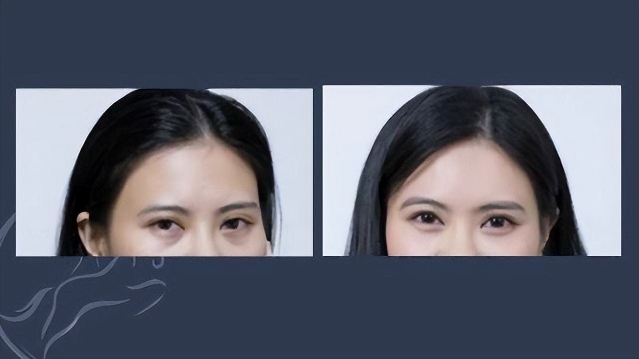 想要拥有最坚定的眼神,想要眼睛迷人又有神