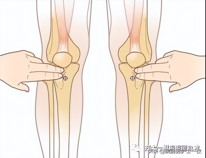 骨髓腔穿刺自动技术操作流程,骨髓腔穿刺急救