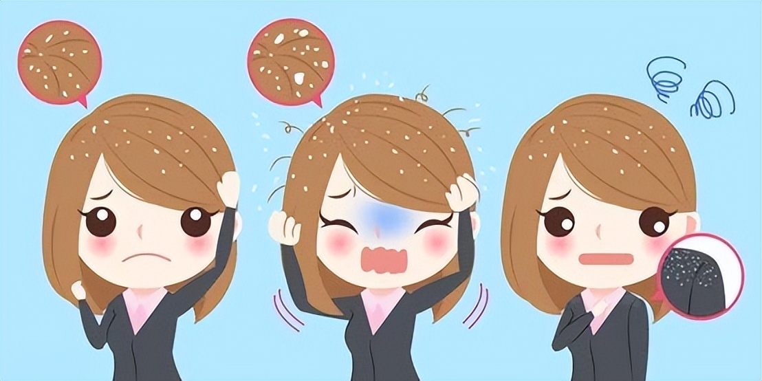 去屑洗发水不能有哪些成分,控油去屑洗发水有什么成分