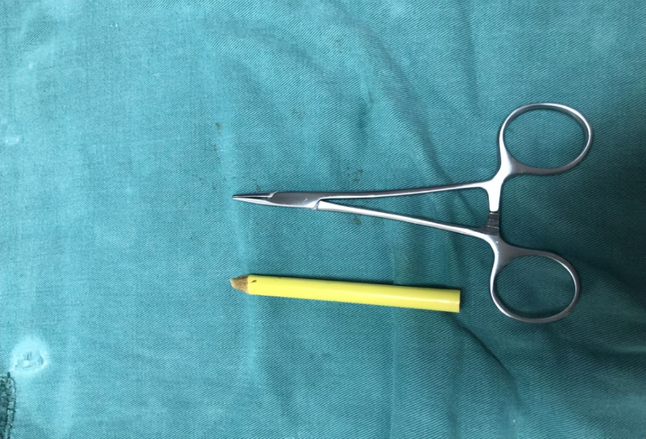 7岁女孩死亡体内却有异物,少女体内被埋神秘异物