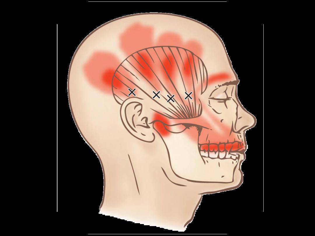 人类最有力的肌肉为什么是舌头,为什么人类最强的肌肉是舌头