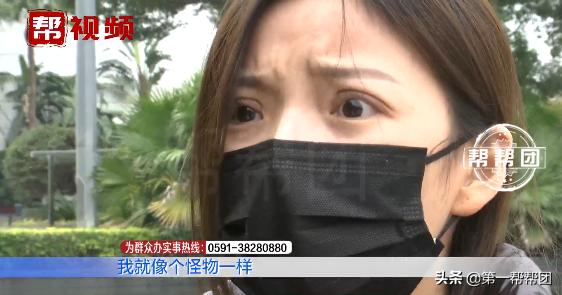 为了美整容整形的失败案例,90后割双眼皮亲身经历