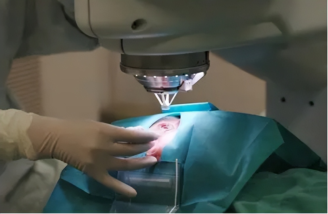 去除老年斑最有效的药膏,用什么药膏治疗老年斑最有效