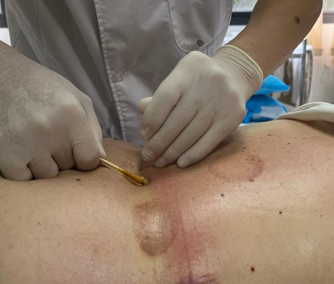 百年传承老福州,百年中医老店的传承