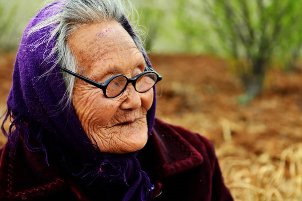 50岁长老年斑是什么原因如何去除,30多岁长老年斑是怎么形成的