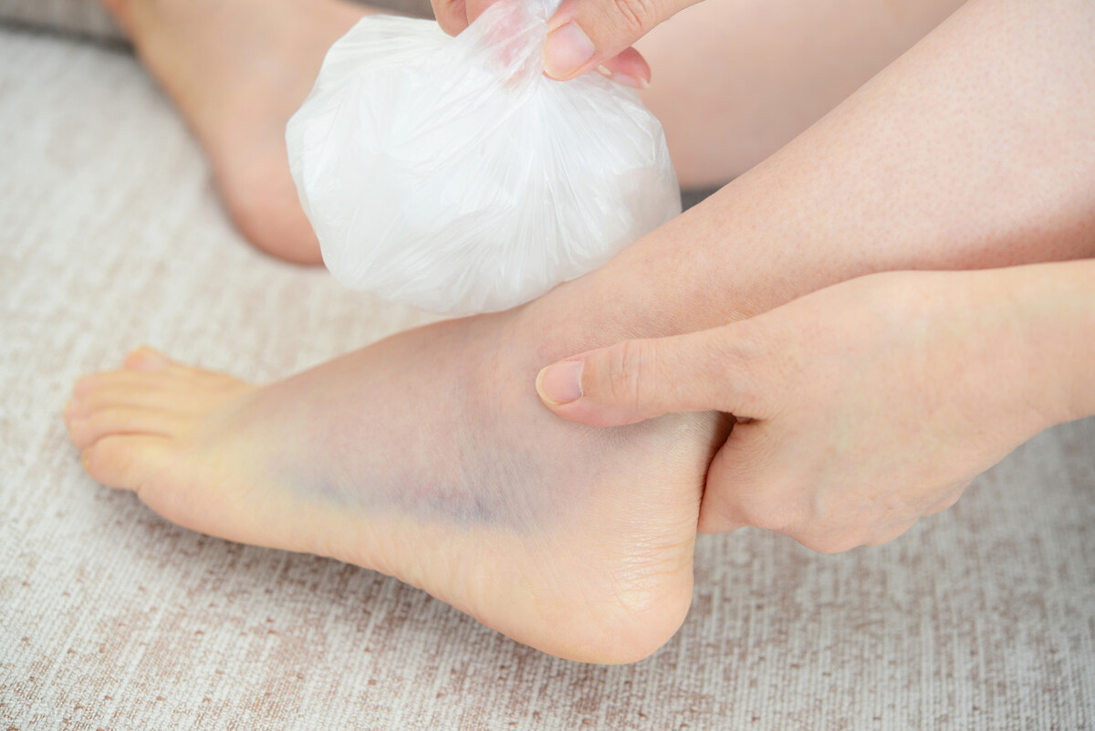 崴脚怎么判断踝关节韧带断裂,没有崴脚脚踝韧带损伤怎么回事