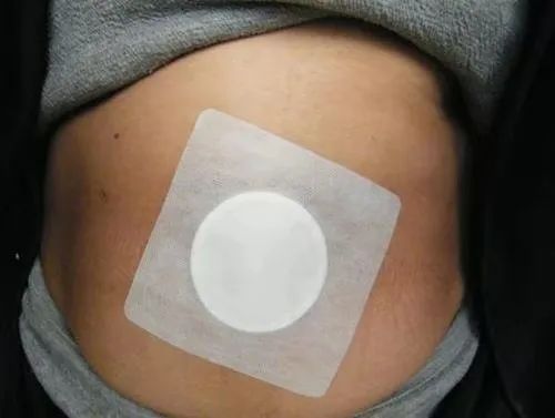 功能性便秘的原因和治疗方法,中医对功能性便秘有办法吗