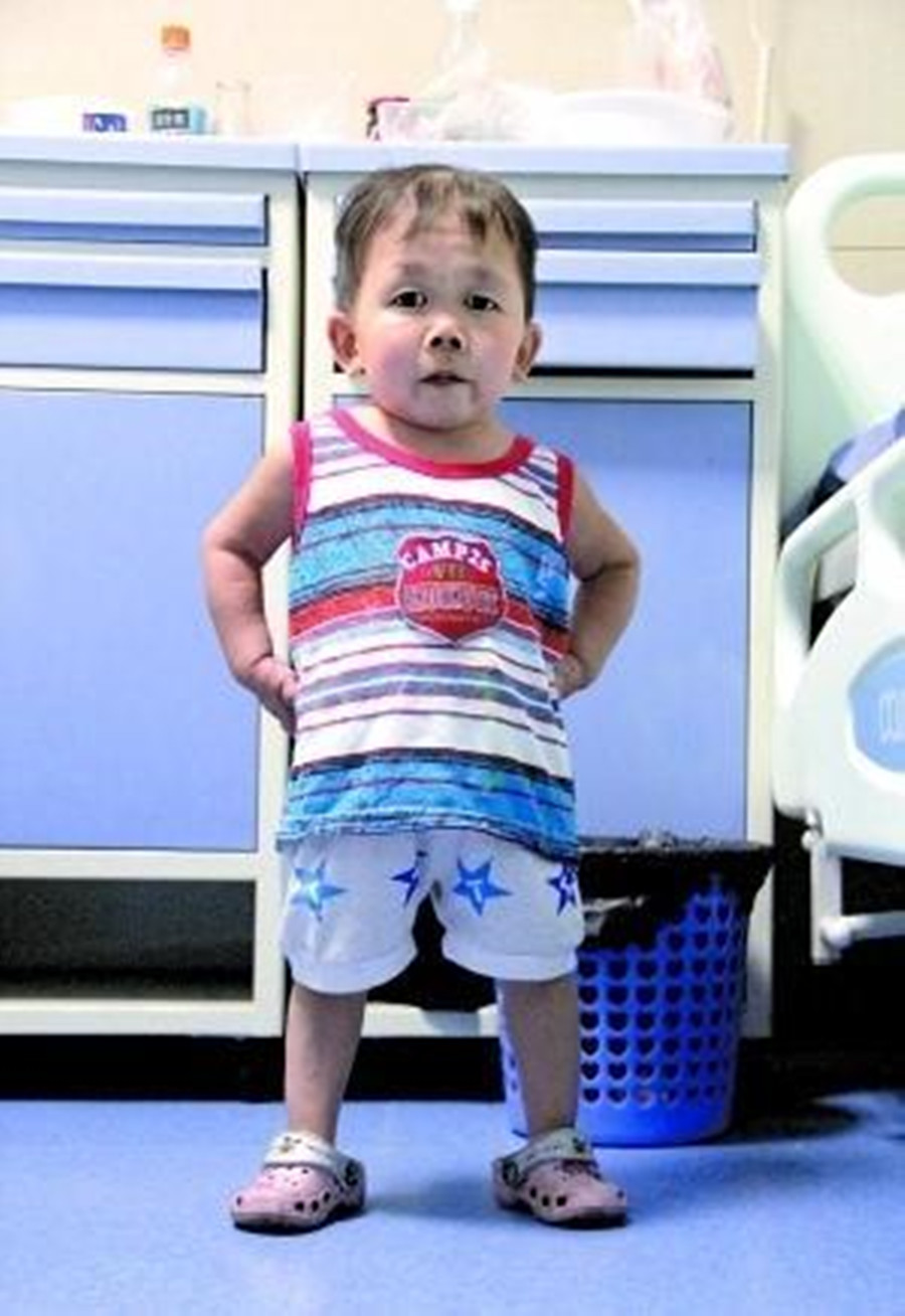 袖珍男子吴康33岁，面容和身高都停留在一岁时期，他如何养活自己