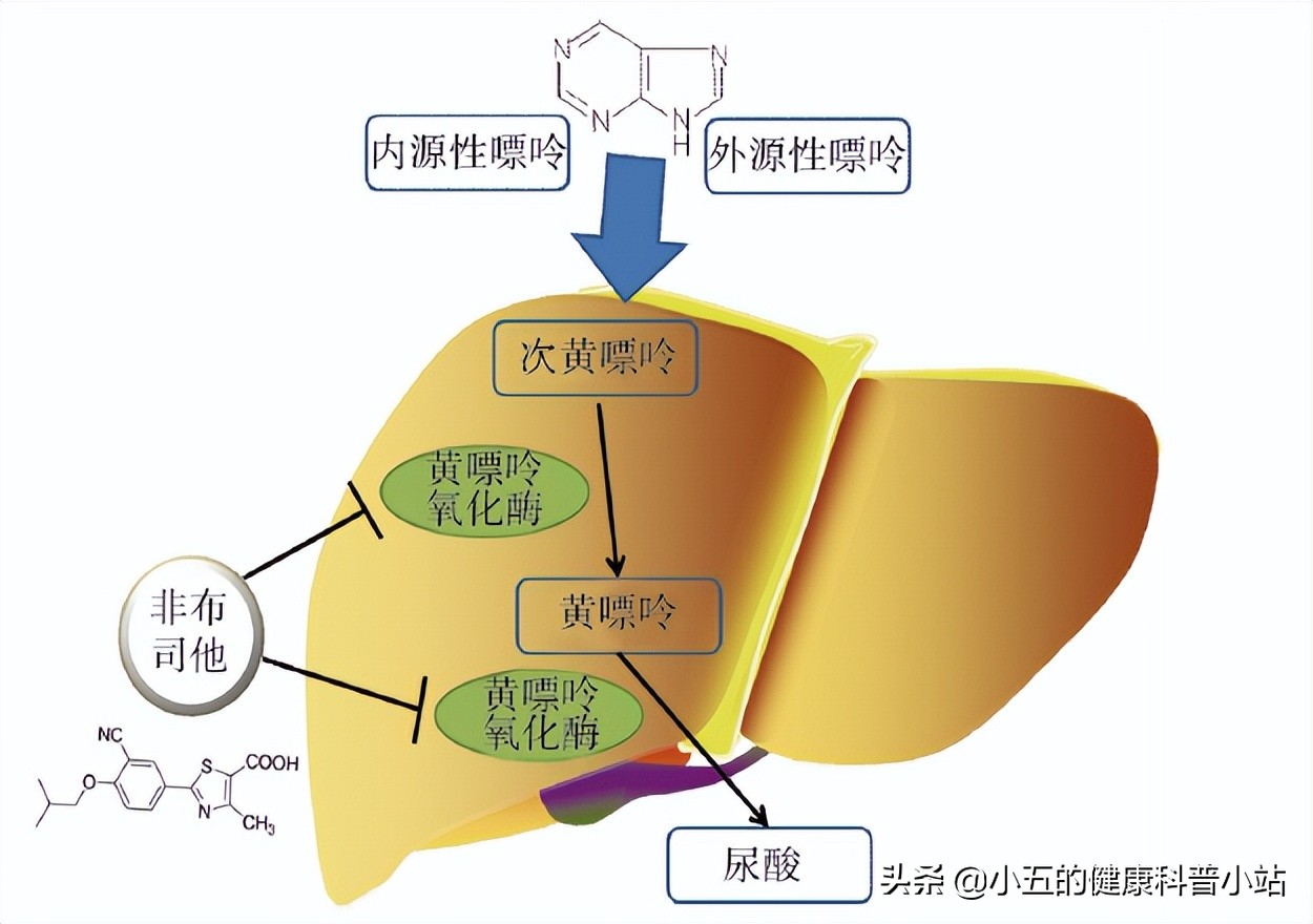非布司他是防治痛风的常用药，可以长期服用，但需要注意这4点