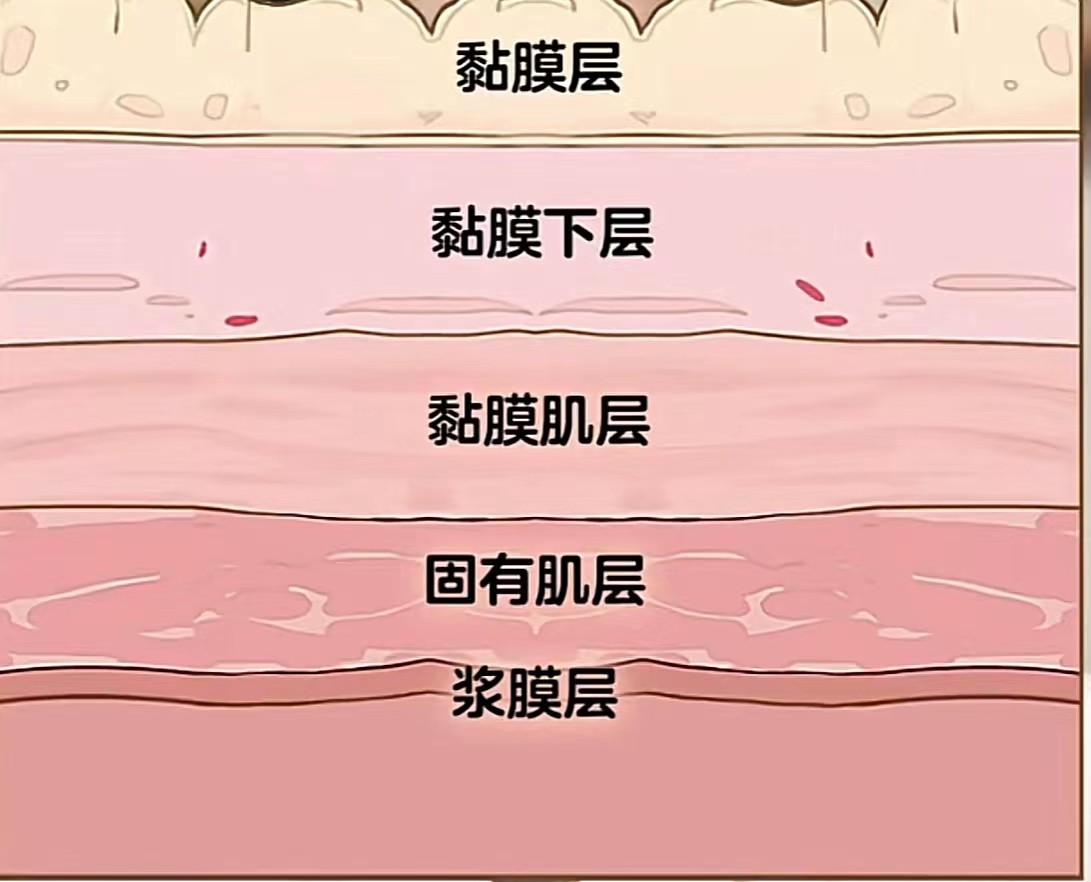 胃不好能吃辣椒炒的菜么,胃不好能吃辣椒和大蒜吗