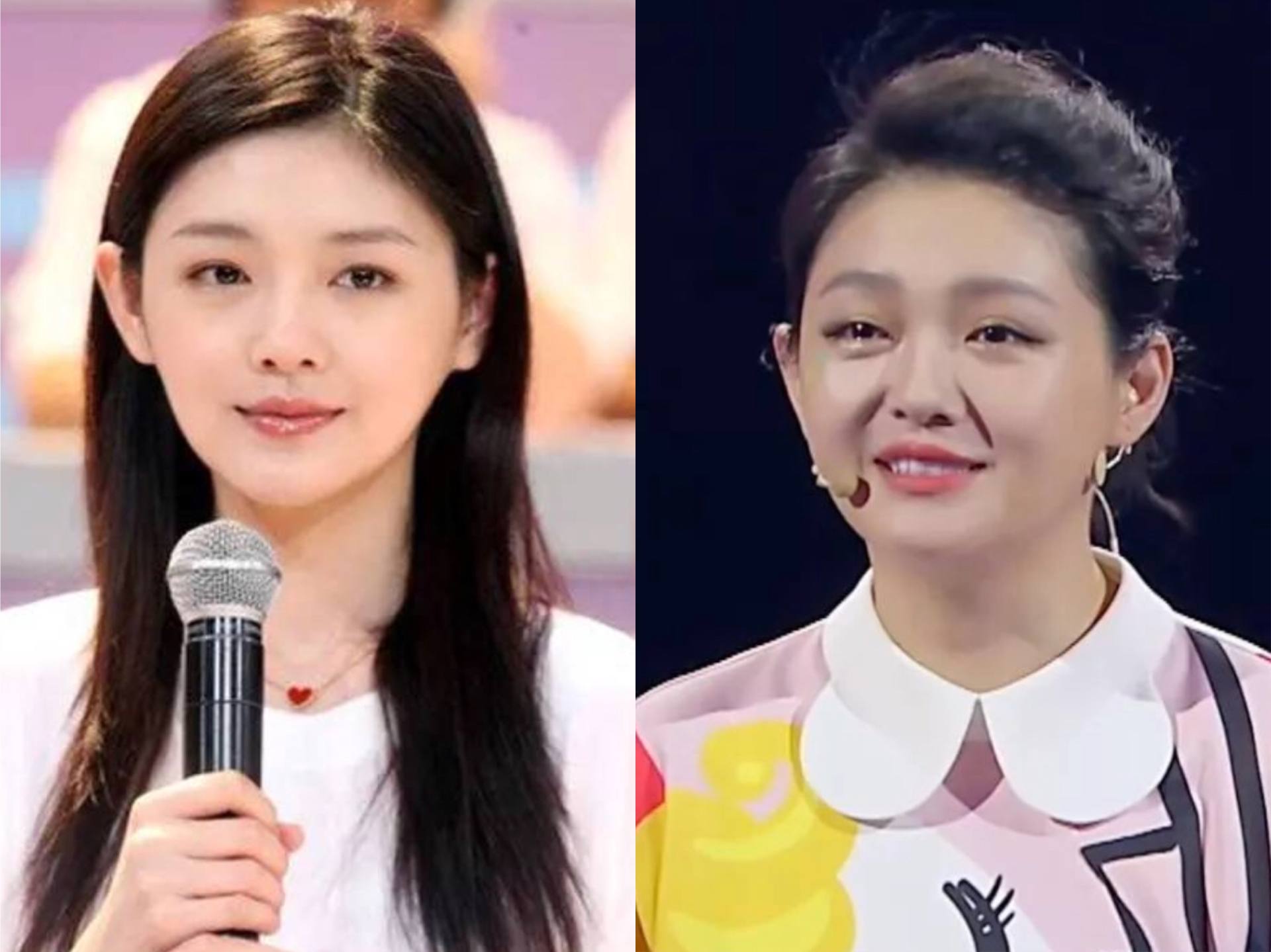 明星脸部僵硬的图片,很多明星脸僵是怎么回事