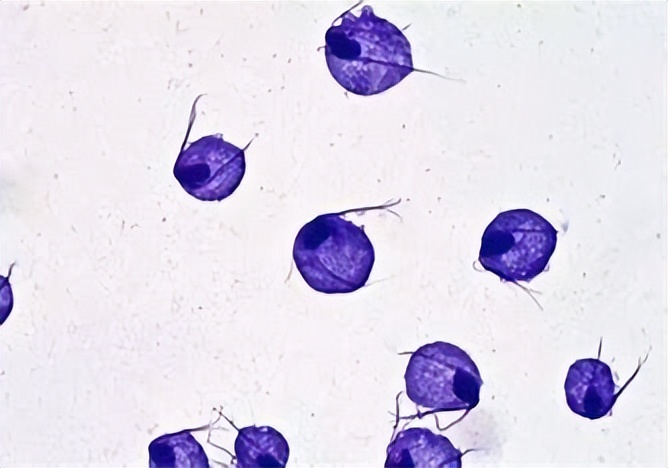 细菌性阴道炎交叉传染有哪些症状,支原体感染引起的阴道炎啥症状