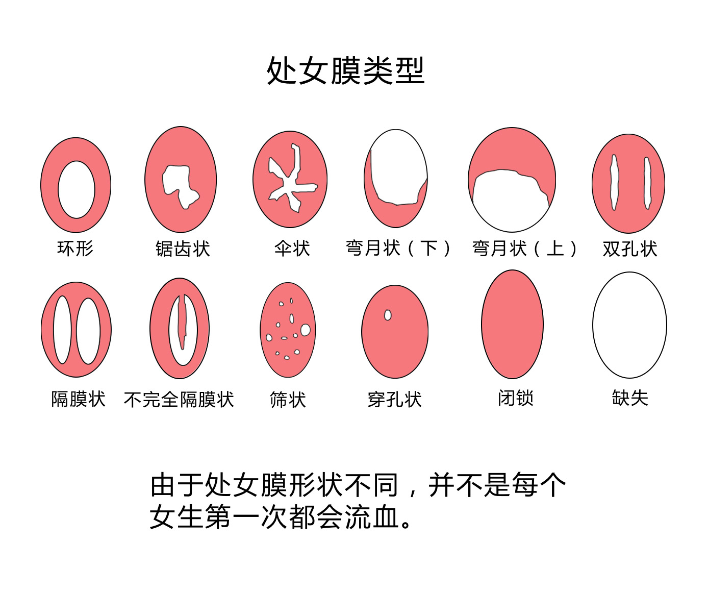 关于处女膜，是时候“捅破”真相了