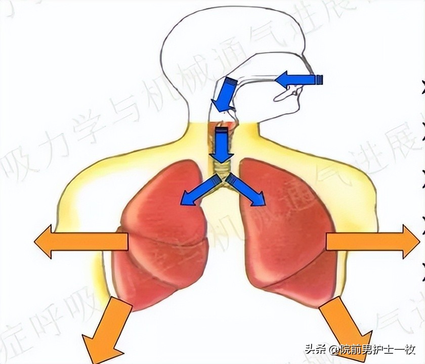 呼吸机应用详解机械通气临床实战,机械通气患者的护理