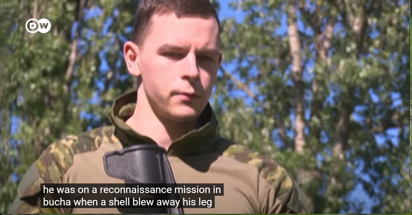 失去双腿的苏联老兵,失去一条腿的退伍军人