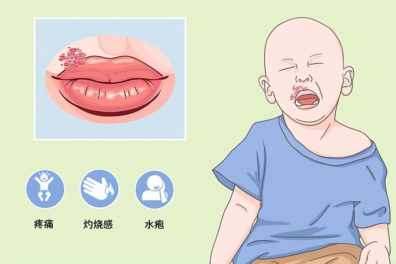 嘴上出了好多透明水泡会传染吗,嘴巴周围长了好多小水泡要忌口吗