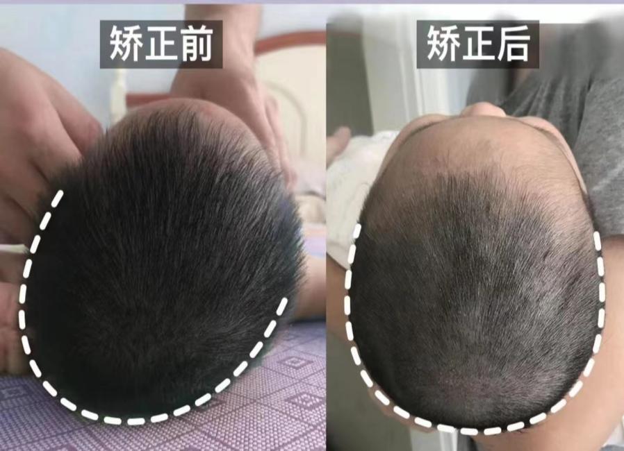 宝宝多大最容易睡偏头,宝宝头睡偏了会影响脸型么