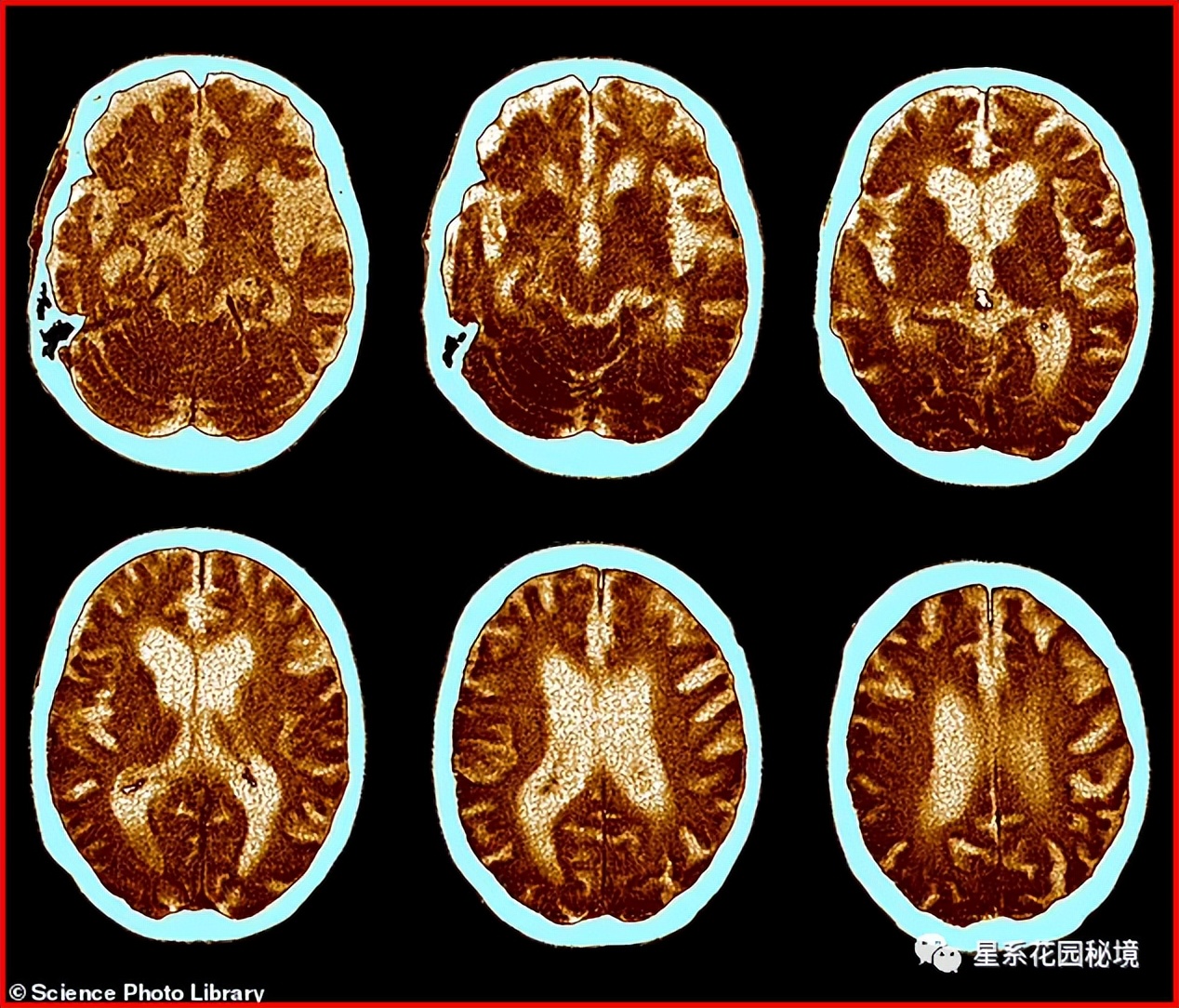 美国学术造假事件,科学数据造假著名事件