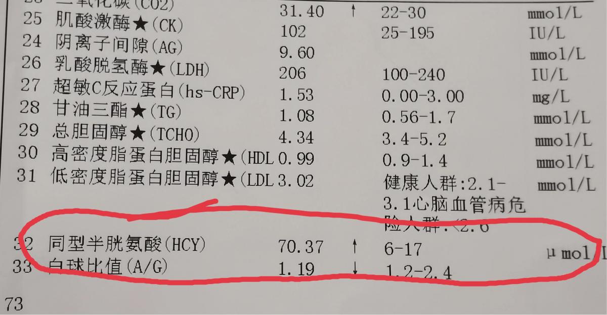 同型半胱氨酸与三高有什么关系,没有三高但同型半胱氨酸高怎么办