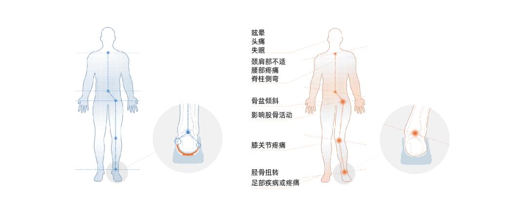 鑺繄瓒冲紦鏀拺,鑺繄璺戦瀷