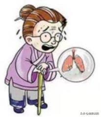 女性盆底健康筛查,妇女盆底健康知识