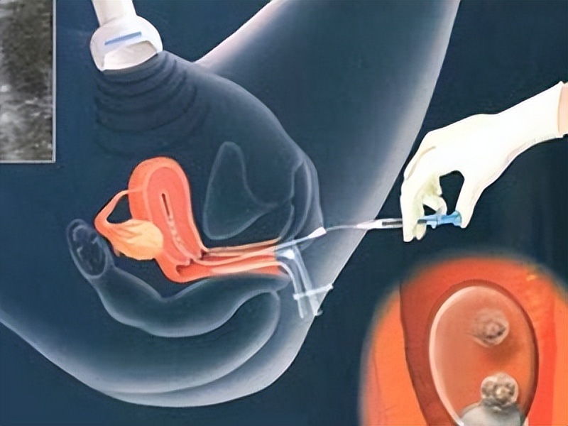 代孕法律是什么意思,代孕在中国属于违法行为吗