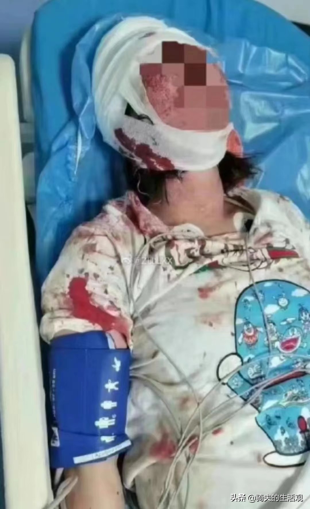 唐山烧烤店打人事件有何观点,媒体人解读唐山烧烤店打人事件