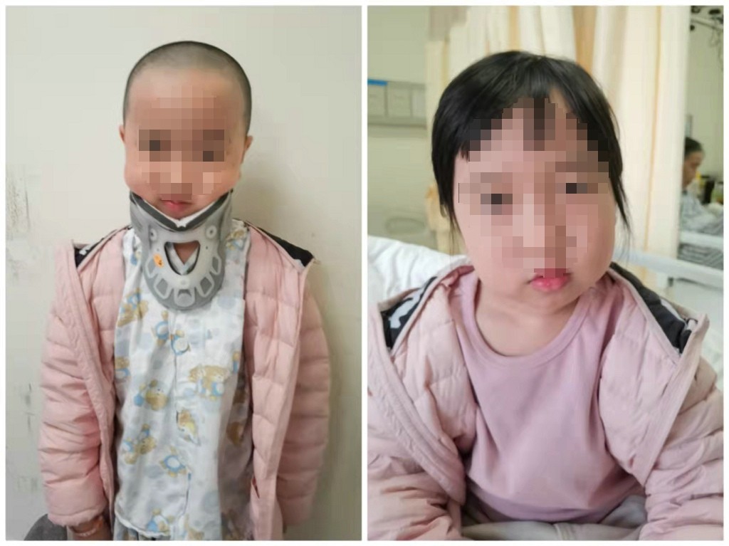 儿童落枕最快恢复办法,落枕了30秒自愈方法儿童