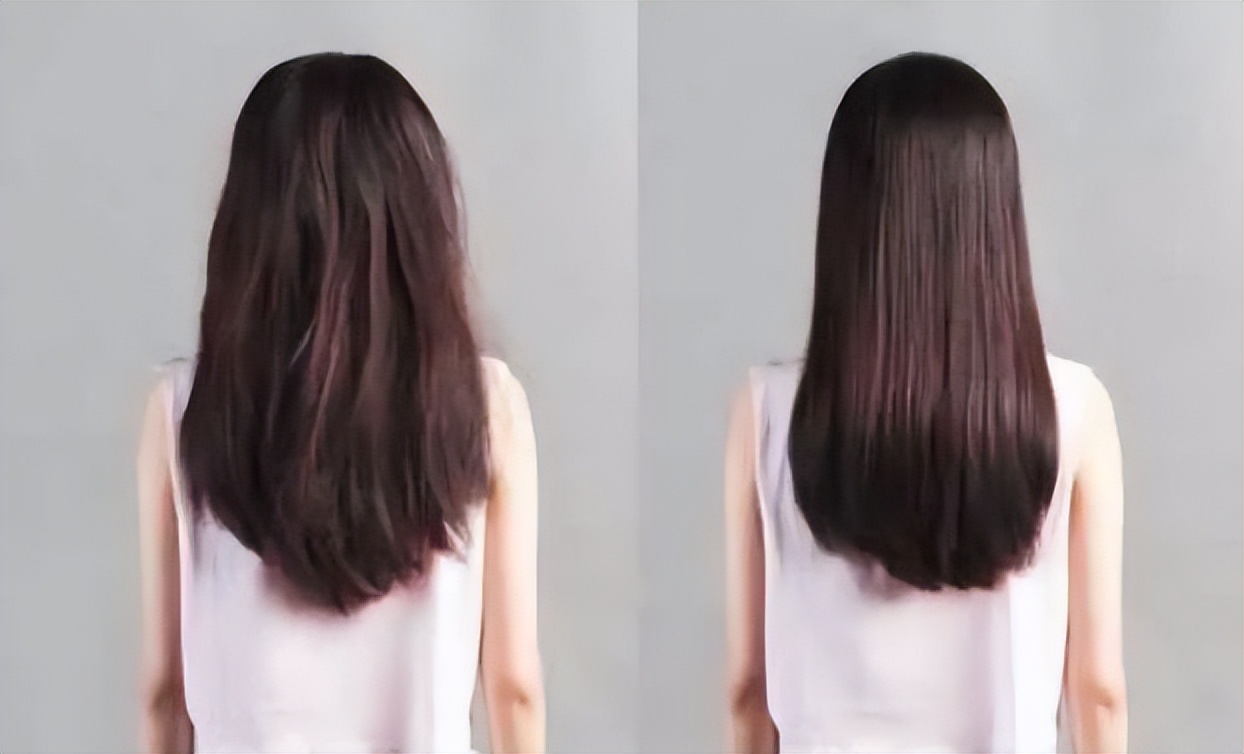 为什么头皮长痘痘和脓包,头皮上长小疙瘩脓包是怎么回事