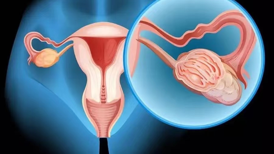 女子婚前检查有2个月身孕,婚前发现子宫有问题