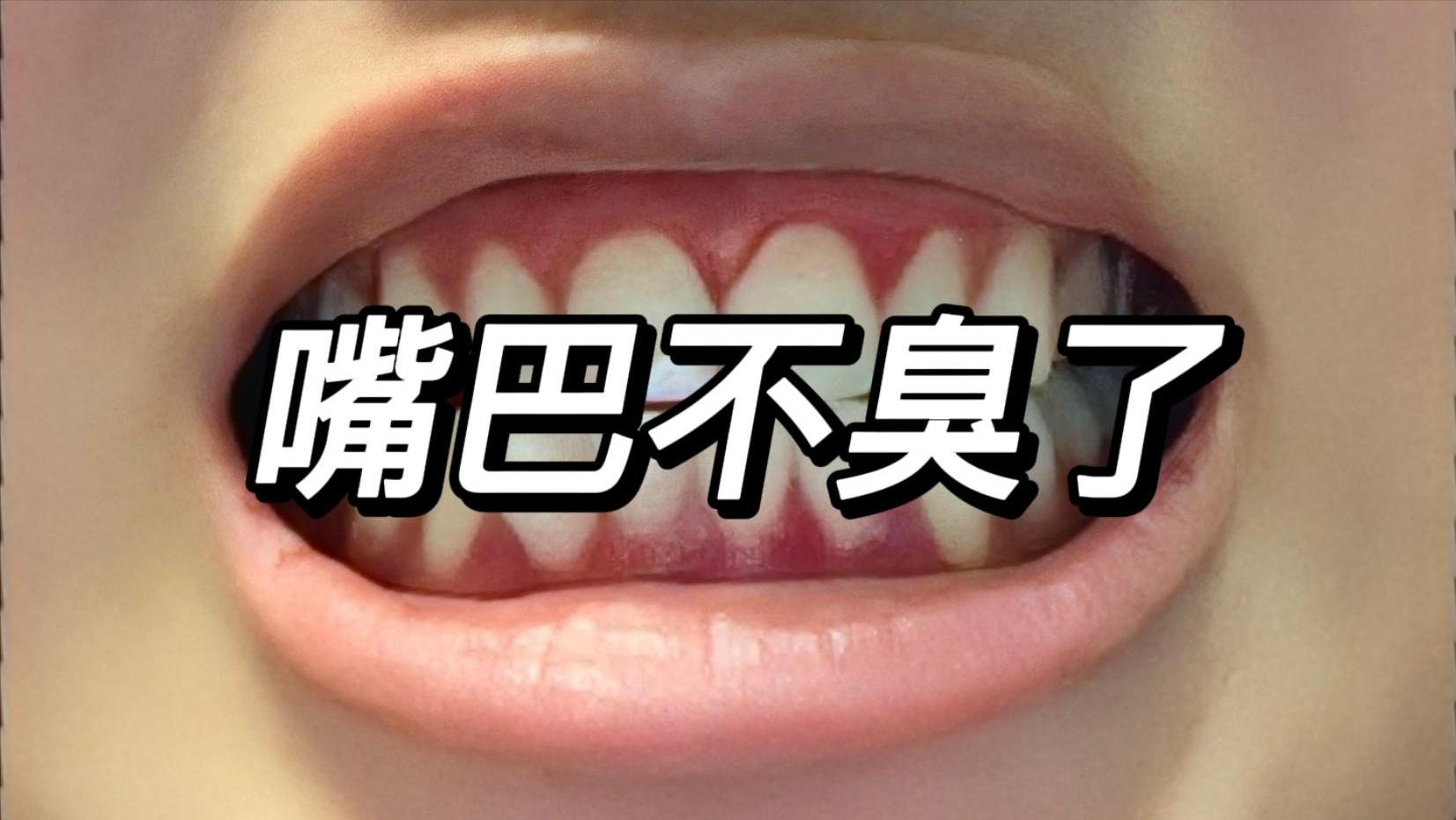 口臭星人口气清新的秘密！过来人一分钟揭晓答案！只需30天！