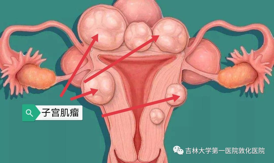 海扶刀很好吗,海扶刀为啥叫海扶刀