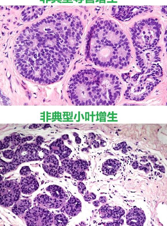 电脑qq如何看撤回的消息,电脑qq怎么看撤回的图片