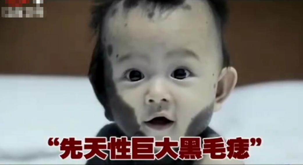 吃竹鼠的熊猫宝宝现在怎么样了,怀孕时吃竹鼠生下奇怪小孩后续