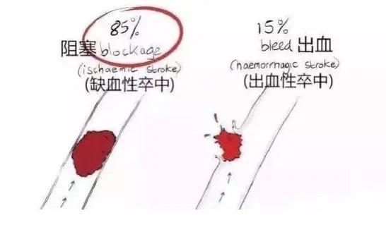 眼斜嘴歪的人怎么对付,嘴歪眼斜是不是中风的表现