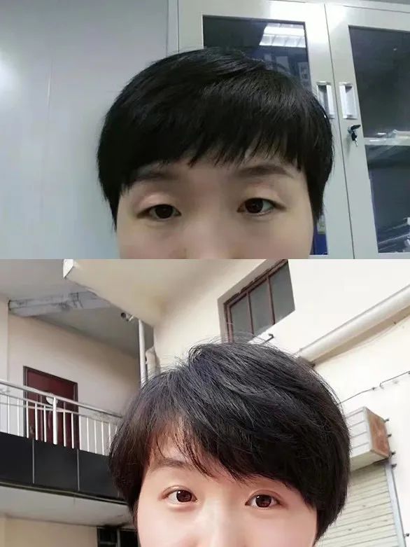 美丽双眸，轻松拥有，让心灵之窗绽放光彩！这些优惠也别错过哦