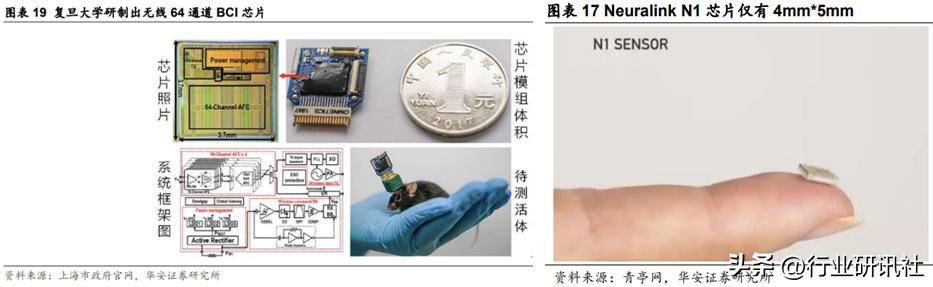 脑机接口发展现状及展望,脑机接口公司靠什么盈利
