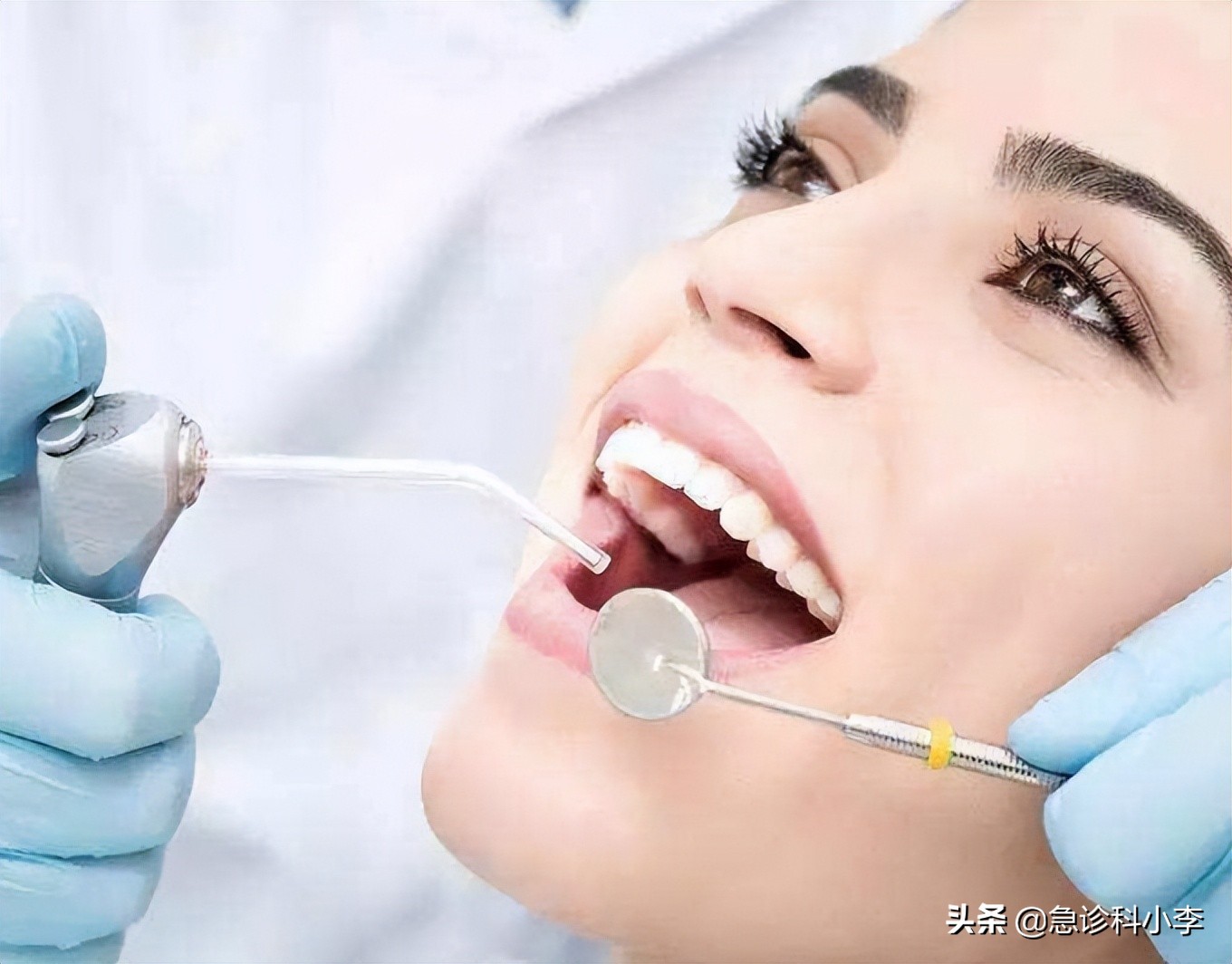 牙缝间的牙结石怎么清除,牙缝里的牙结石怎么去除