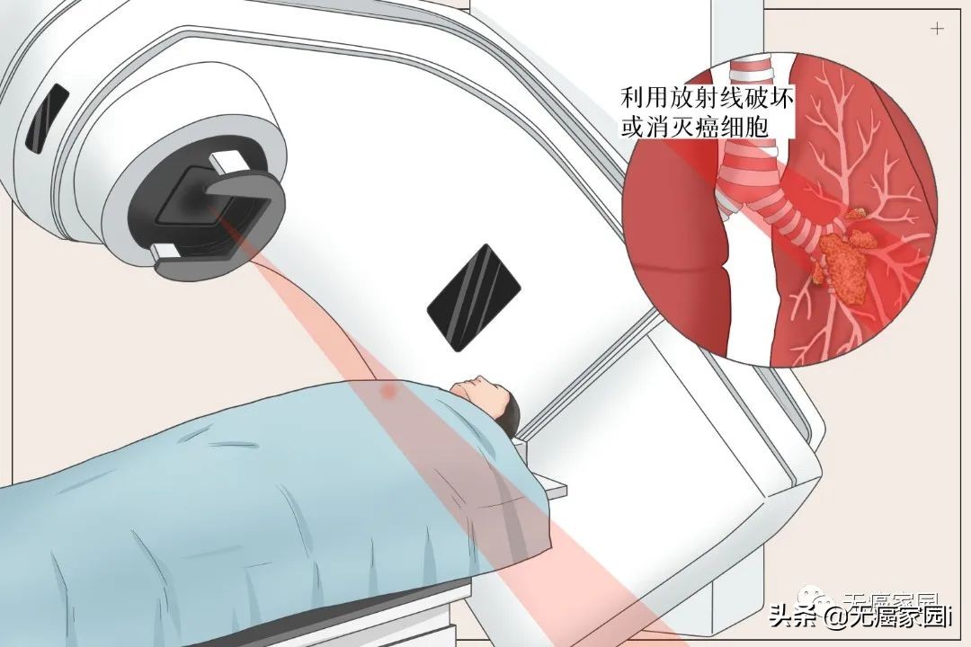 脑瘤、肺癌及儿童肿瘤等不妨考虑质子治疗,疗效和生存质量双保障