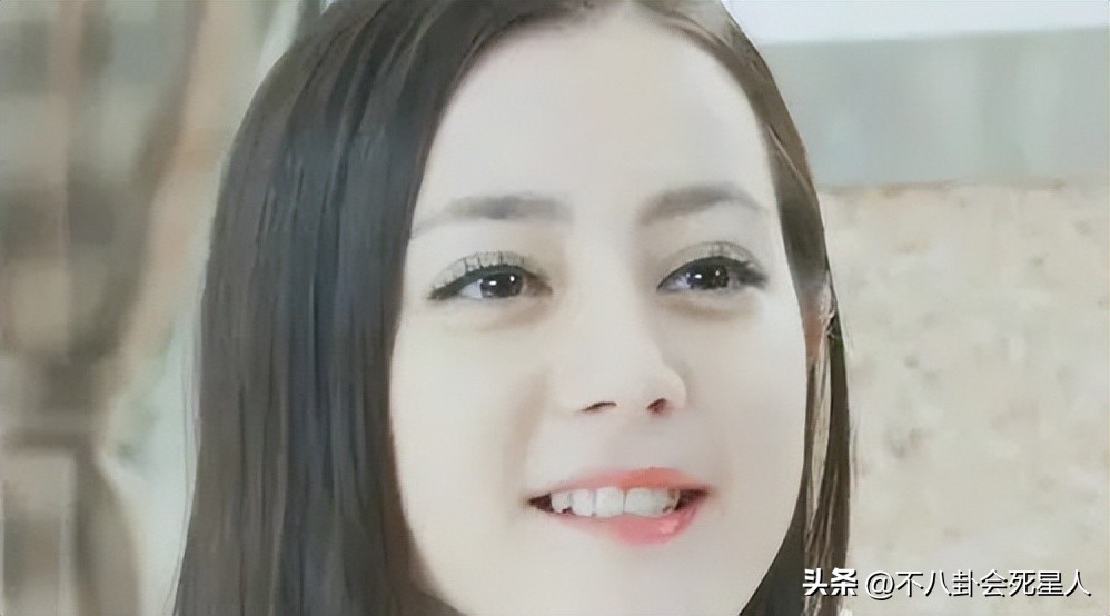 烤瓷牙有多恐怖,烤瓷牙害我一生