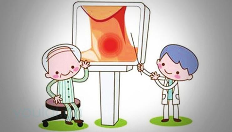 TPO-Ab抗甲状腺过氧化物酶抗体过高对人有哪些影响？如何降低？