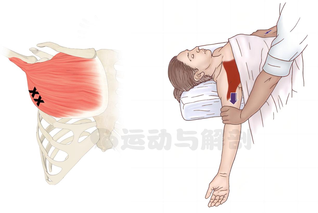 胸大太松怎样练紧致,胸大肌太过紧张要松解多久