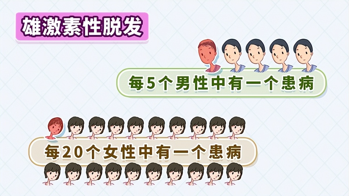 男性谢顶主要在什么年龄,50岁的男生谢顶最快的方法