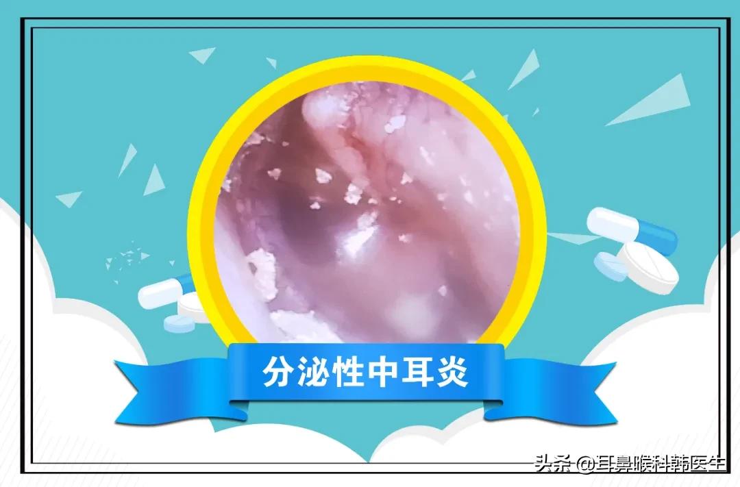 耳鼻喉科电子内窥镜能检查什么病,耳鼻喉内窥镜详细操作流程考核表