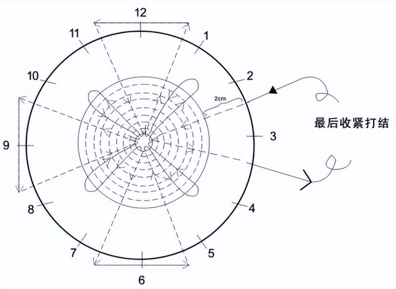 派特灵派特生物科普｜冷刀宫颈锥切术操作步骤和注意事项