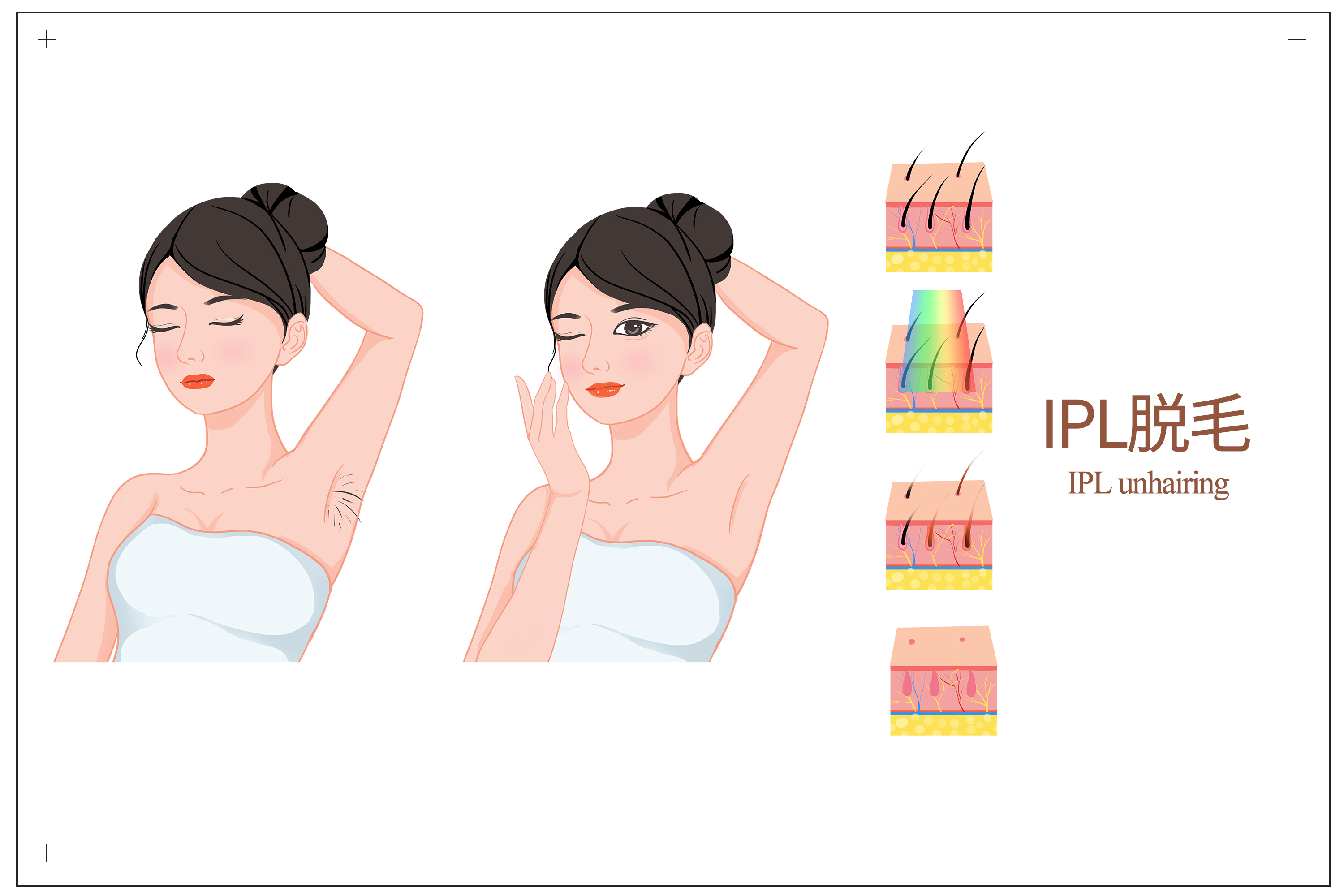 脱毛仪到底是黑科技还是智商税,脱毛仪是智商税还是高科技神器