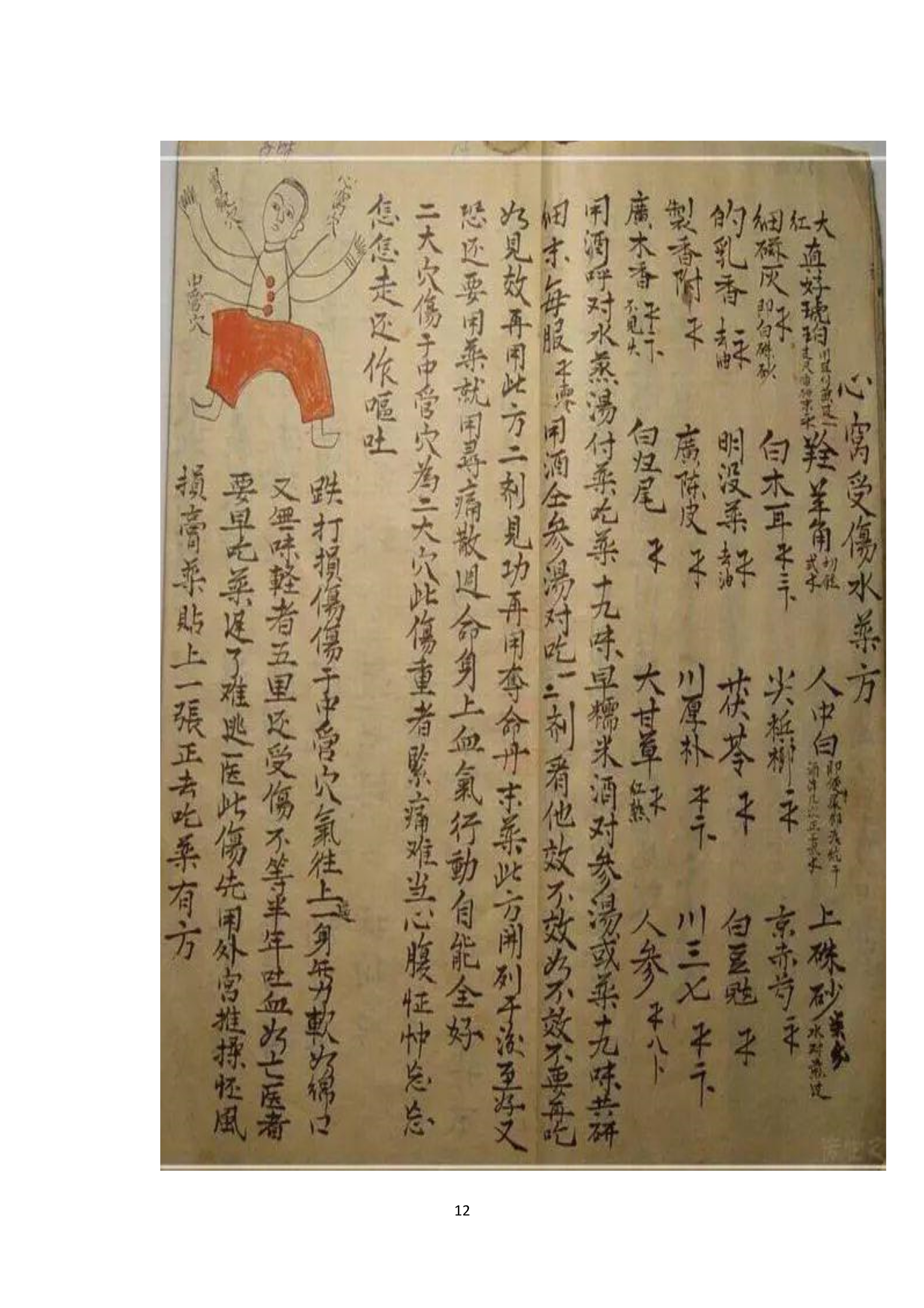 中医古书籍清代带图且内容非常好的手抄跌打损伤良方