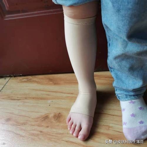 手术后留下的疤怎么消除,手术后疤痕很红怎么处理