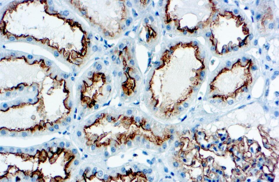 这七个体检指标异常不用过度治疗,14项体检常见指标异常解读